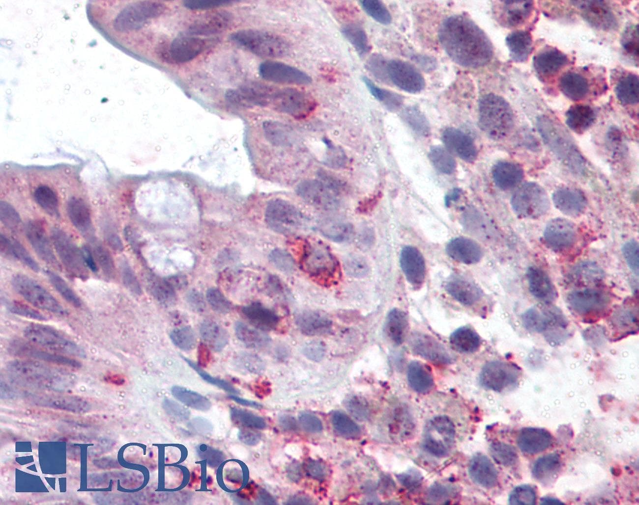 PathPlus™ Polyclonal Rabbit anti-Human GPR49 / LGR5 Antibody (Cytoplasmic Domain, IHC, IF)