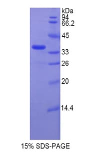 Rat TERT / Telomerase Protein (Recombinant His)