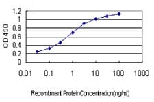 TMPRSS15 / Enterokinase Antibody (clone 3F8)