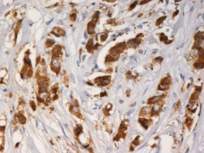 AG3 / AGR3 Antibody (clone AGR3.1)
