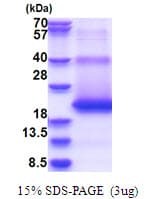 Human M6PR Protein (Recombinant His)
