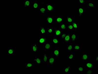 HIST1H1C Antibody