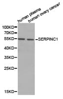 Antithrombin-III Antibody
