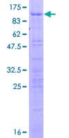 Human RBM39 Protein (Recombinant GST)