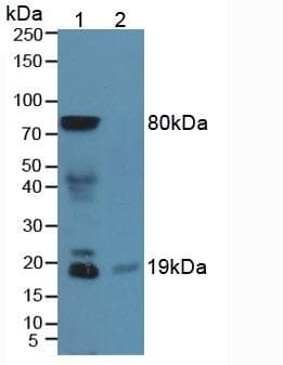 SST / Somatostatin Antibody (aa1-116)