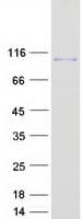 Human VPS39 Protein (Recombinant Myc-DDK (Flag))