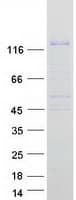 Human Hairless / HR Protein (Recombinant Myc-DDK (Flag))