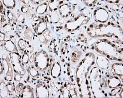 ACSBG1 / hsBG Antibody (clone OTI2B6)