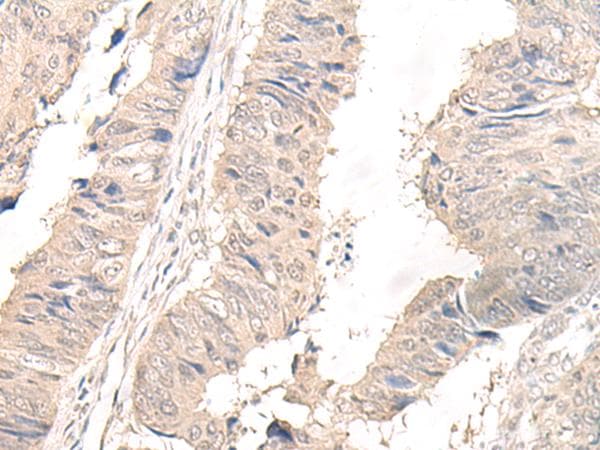 Polyclonal Rabbit anti-Human OLA1 Antibody (IHC, WB)
