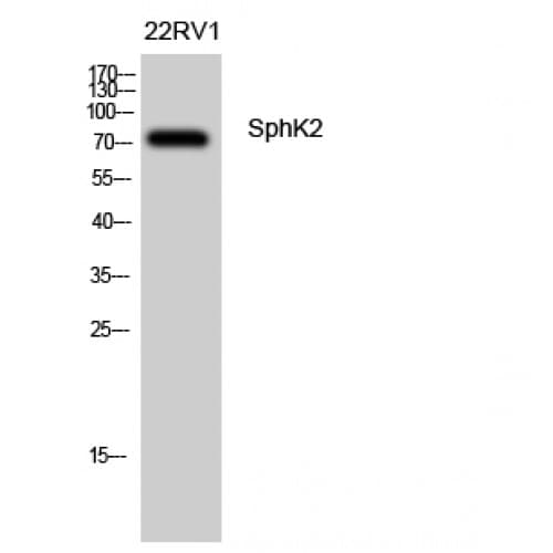 Polyclonal Rabbit anti-Human SPHK2 Antibody (550-630 aa, IHC, WB)