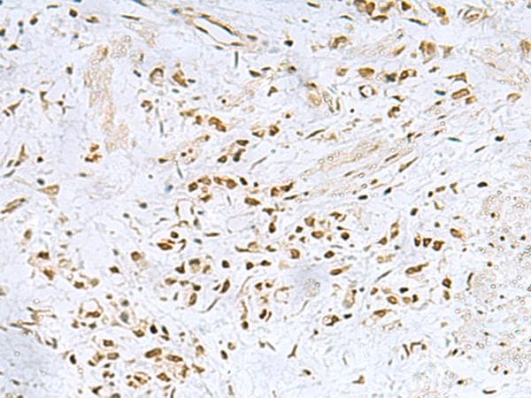 Polyclonal Rabbit anti-Human FOXQ1 Antibody (IHC, WB)