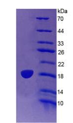 Mouse LCAT Protein (Recombinant His)