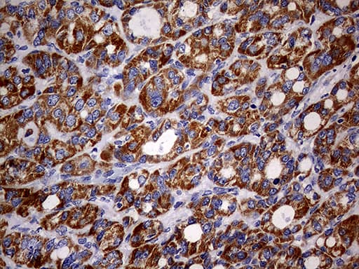 MAK Antibody (aa291-623, clone OTI1G2)