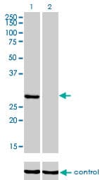 KHK / Ketohexokinase Antibody (clone 1H6-2B6)