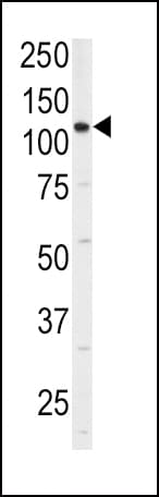 IHC-plus™ ITGA6/Integrin Alpha 6/CD49f Antibody (aa1043-1072)