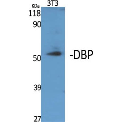 GC / Vitamin D-Binding Protein Antibody (90-170 aa, Internal)