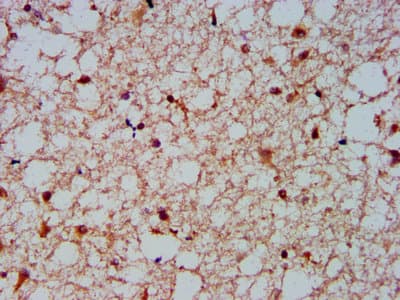 NFKBIL1 Antibody