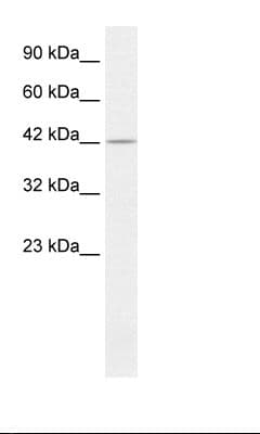 PSMD4 / RPN10 Antibody (C-Terminus, Biotin)