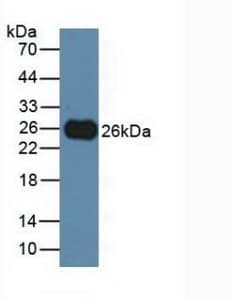 TIGIT Antibody (aa28-227, Cy3)