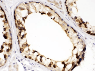 Polyclonal Rabbit anti-Human CCT2 / CCT Beta Antibody (IHC, WB)