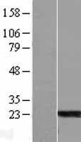 ARL6 Protein (Over-Expression Lysate Myc-DDK (Flag))