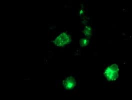 APP / Beta Amyloid Precursor Antibody (clone OTI1E6)