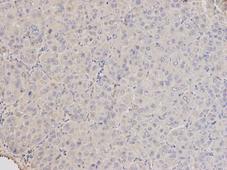Polyclonal Rabbit anti-Human ARRB1 / Beta Arrestin 1 Antibody (IHC, IF, WB)