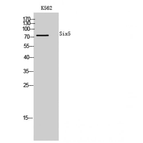 Polyclonal Rabbit anti-Human SIX5 Antibody (180-260 aa, Internal, WB)