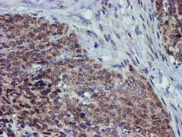 ALOX15 / 15-Lipoxygenase Antibody (clone OTI2G3)