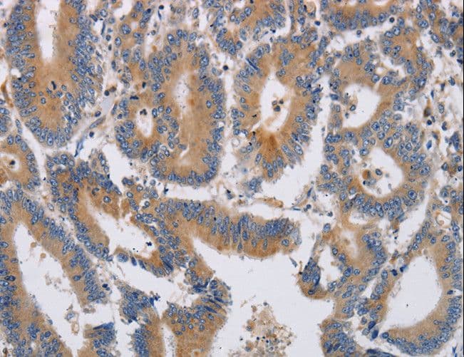 Polyclonal Rabbit anti-Human K13 / KCNG Antibody (IHC)