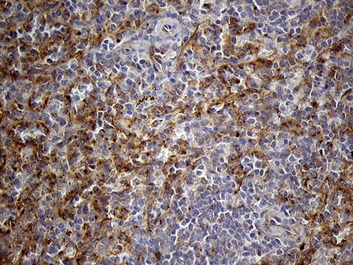 Monoclonal Mouse anti-Human IFITM2 Antibody (clone OTI4E3, IHC, WB)