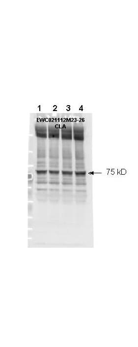 IHC-plus™ Polyclonal Rabbit anti-Human NF2 / Merlin Antibody (phospho-Ser518, IHC, WB)