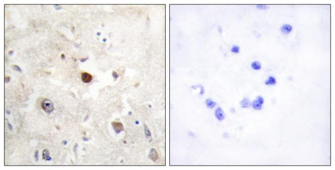 Polyclonal Rabbit anti-Human CDKN1C / p57 Kip2 Antibody (IHC)