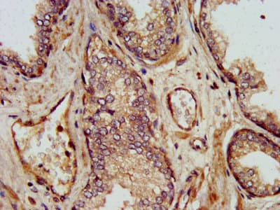 Polyclonal Rabbit anti-Human SHARPIN Antibody (IHC, IF, WB)