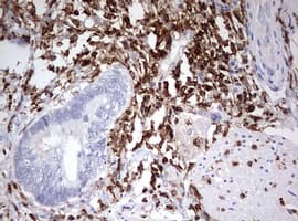 Monoclonal Mouse anti-Human DOCK2 Antibody (clone OTI7G2, aa1544-1830, IHC, WB)