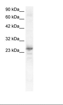 NKX2-8 Antibody (C-Terminus)