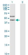 PathPlus™ Monoclonal Mouse anti-Human Alpha-1-Antichymotrypsin Antibody (clone 1E6, IHC, WB)