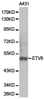 ETV6 / TEL Antibody