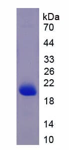 Human Apolipoprotein A-V (Recombinant His)