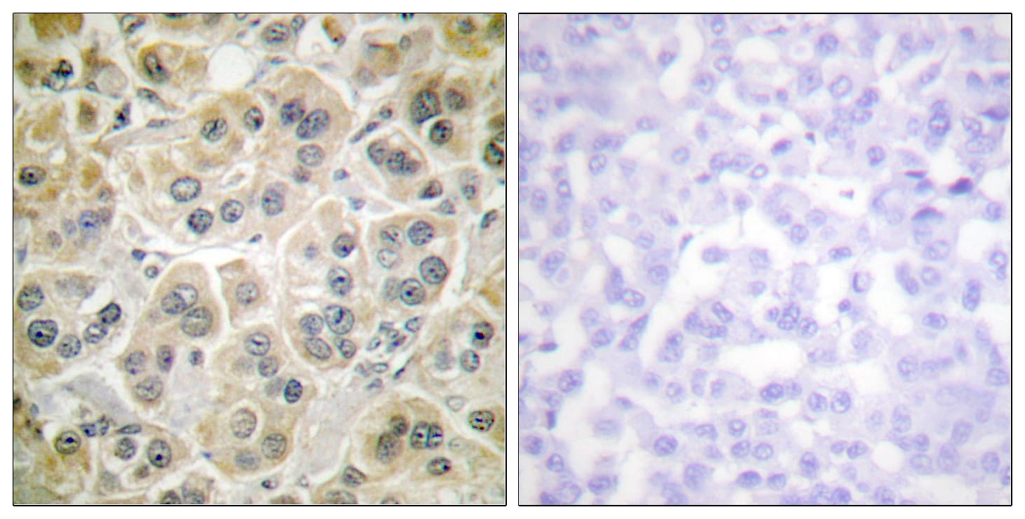 Polyclonal Rabbit anti-Human Vimentin Antibody (aa411-460, IHC, WB)