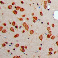 SST / Somatostatin Antibody (N-Terminus)