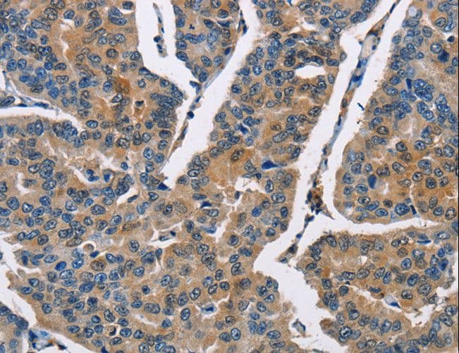 CBR / CBR1 Antibody
