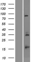 Human RPS23 / Ribosomal Protein S23 (Over-Expression Lysate Myc-DDK (Flag))
