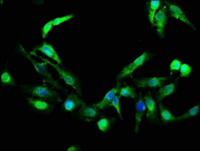 IHC-plus™ GZMB / Granzyme B Antibody (aa21-247)