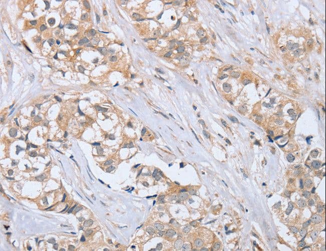 PTPMEG / PTPN4 Antibody