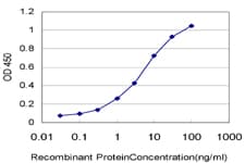Monoclonal Mouse anti-Human DTX3L Antibody (clone 1D10, WB)