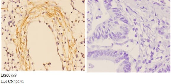 ABCA4 Antibody