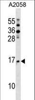 NAT5 / NAA20 Antibody (aa127-155)