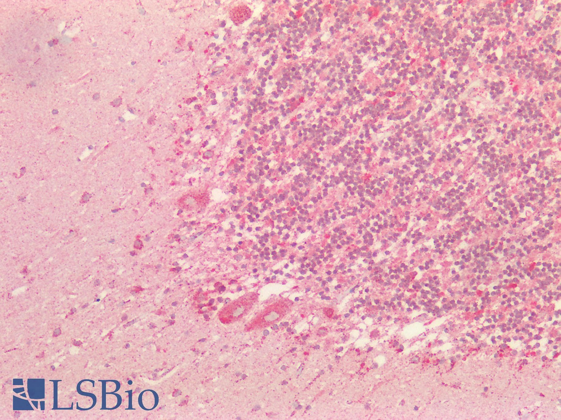 Polyclonal Rabbit anti-Human S100 Protein Antibody (IHC, IF, WB)