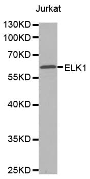 NBN / Nibrin Antibody